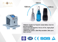 certificazione facile del CE di operazione della macchina 532nm di rimozione del tatuaggio del laser della lampada di 140mm * di 6